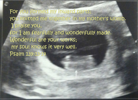 Psalm 139:13-14 The photo is taken from the ultrasound of my grandniece or grandnephew. the Baby is 9 weeks and days old here.